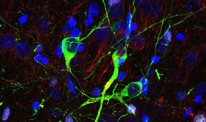 Neurogenesi adulta e neuroni “immaturi” nei mammiferi: un TRADE-OFF evolutivo per la plasticità?