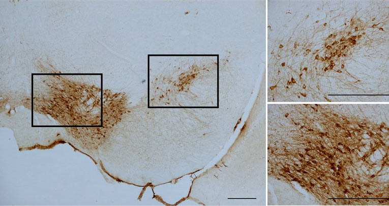 NURR1 deficiency is associated to ADHD-like phenotypes in mice