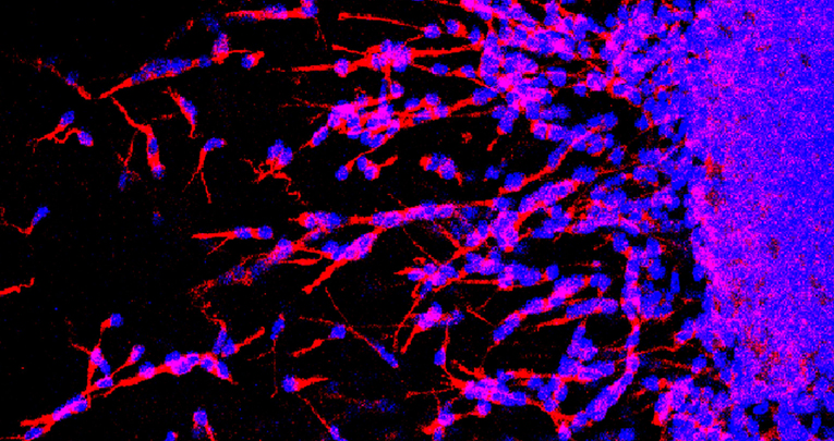 Control of Cell Shape, Neurite Outgrowth, and Migration by a Nogo-A/HSPG Interaction