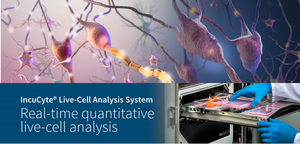 Live-Cell Analysis Workshop - A discussion on IncuCyte S3®