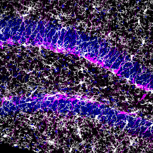 Microglia-DCX-DAPI_web