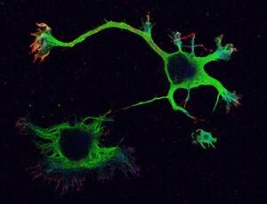neurone in coltura