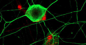 Nuovi orizzonti nella rigenerazione dei nervi: il futuro della ricerca