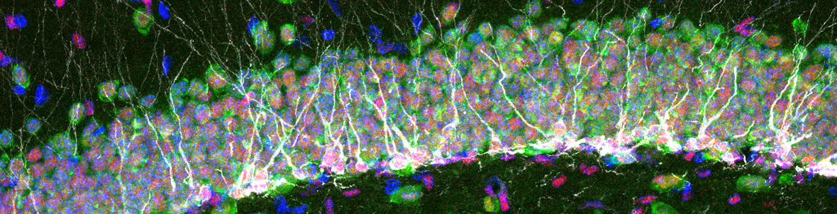 adult-neurogenesis_bonfanti