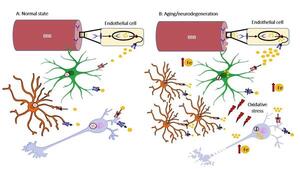 Ferro e mitocondri: nuovi target contro la malattia di Alzheimer