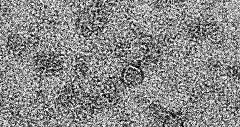 A First Phenotypic and Functional Characterization of Placental Extracellular Vesicles from Women with Multiple Sclerosis