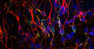 Phylogenetic variation in cortical layer II immature neuron reservoir of mammals