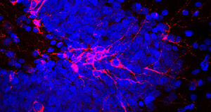 In cerca di alternative alla rigenerazione cerebrale