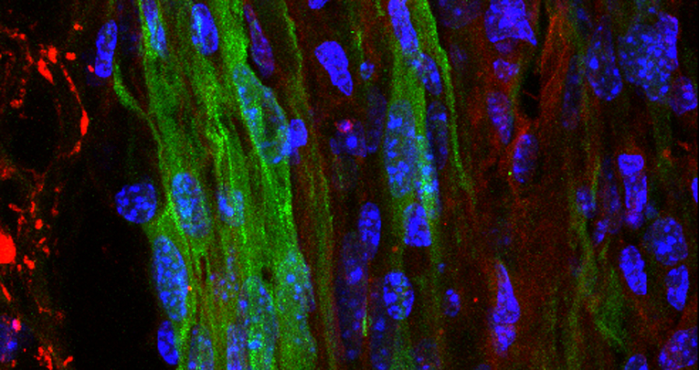 Successful in vivo MRI tracking of MSCs labeled with Gadoteridol in a Spinal Cord Injury experimental model