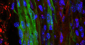 Lesioni midollari: nuova procedura di labelling per seguire il destino delle cellule trapiantate in vivo