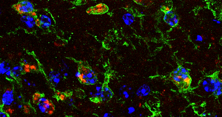 Lesioni spinali: due nuove ricerche su rigenerazione e neuroinfiammazione