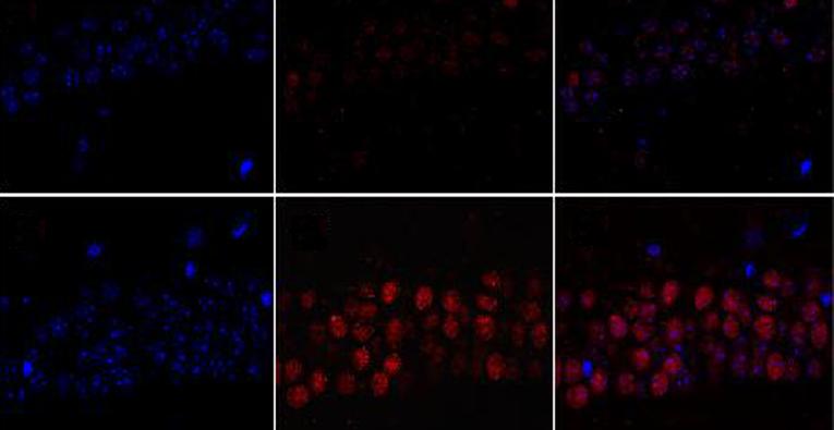 Beta-amyloid 1-42 monomers, but not oligomers, produce PHF-like conformation of Tau protein.