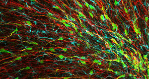 Nuovi neuroni: che farne?