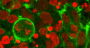 Organoidi cerebrali: un modello ideale per lo studio delle microcefalie umane