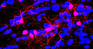 Polveri sottili e Sclerosi multipla: dimostrato l’effetto su neuroinfiammazione  e riparazione della mielina