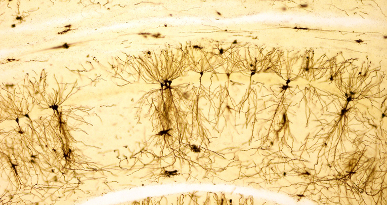 Glia-to-neuron transfer of miRNAs via extracellular vesicles: a new mechanism underlying inflammation-induced synaptic alterations.